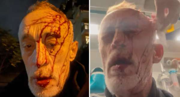 აქციების მონაწილე ნადიმ ხმალაძეს სახლთან ფიზიკურად გაუსწორდნენ