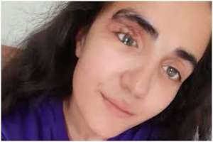 ,,თვალში მიდევს პირველი პროთეზი, რომელიც არ შეიძლება" - მაკო გომური წერილს ავრცელებს