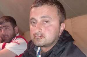 ჭიათურაში ერთ-ერთმა მაღაროელმა პირი ამოიკერა