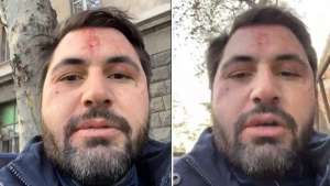 ლაშა გაბიტაშვილი აცხადებს, რომ სახლთან თავს დაესხა სამი ნიღბიანი