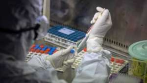 "კორონავირუსი და ჯილეხი"- 42 წლის ქალი თბილისში გადმოიყვანეს