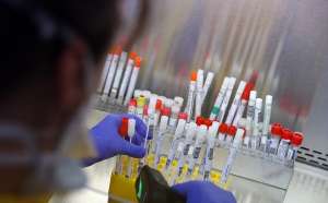 საქართველოში კორონავირუსით ინფიცირების 222 ახალი შემთხვევა დაფიქსირდა, გარდაიცვალა კიდევ 1 პაციენტი